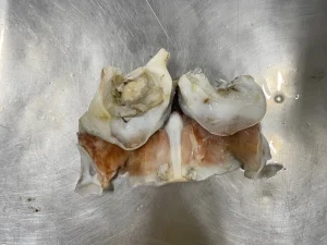 Giant Squid Neck