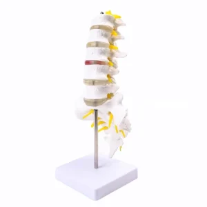 Life-Size Lumbar Vertebrae with Sacrum & Coccyx Herniated Disc for Medical Science for Hospitals