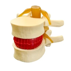 Medical Science Spine Model Human Anatomy Lumbar Vertebrae Skeleton Model